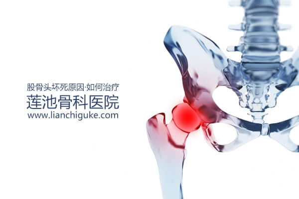 股骨頭壞死原因？如何治療股骨頭壞死？