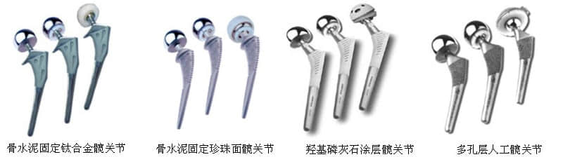 股骨頭壞死關(guān)節(jié)置換假體價格