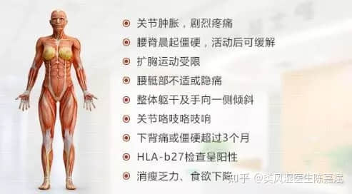 患上了強(qiáng)直性脊柱炎，小心膝關(guān)節(jié)出現(xiàn)關(guān)節(jié)炎。