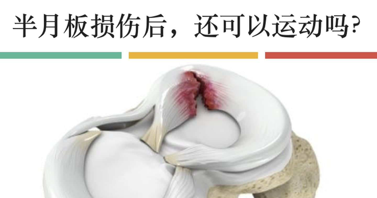 半月板損傷如何發(fā)生？半月板損傷多久能恢復(fù)