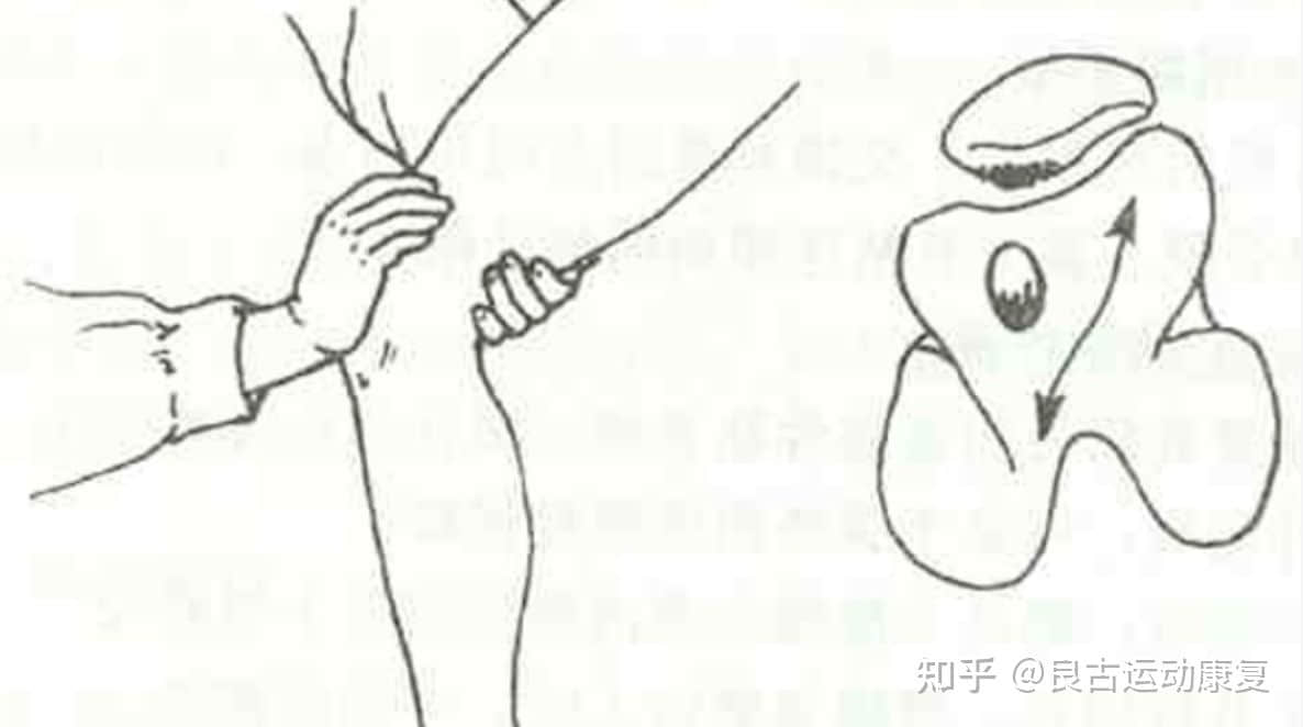 這個膝痛是最常見的運動損傷，如何自我康復？