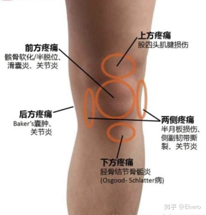 膝關(guān)節(jié)總發(fā)出聲響是怎么回事？