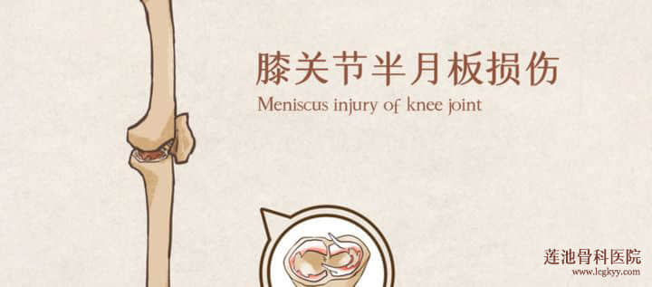 關(guān)節(jié)鏡手術(shù)的體驗如何？
