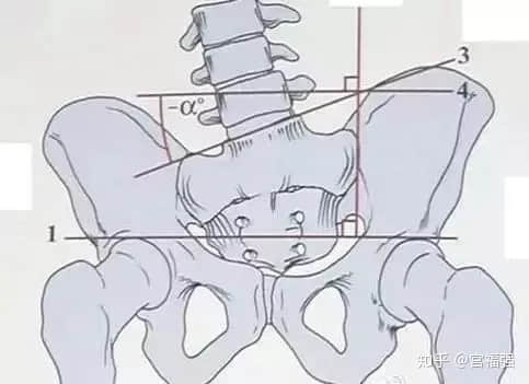 蹺二郎腿，是怎么讓人悄悄“變丑”的？
